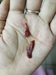 流产后吃黑瓜好吗会回奶吗,流产后食用黑瓜影响及回奶风险探讨